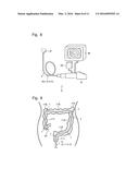 BENDING DEVICE diagram and image