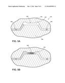 HYBRID COMPOSITE INSTRUMENT PANEL diagram and image