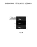 Transposition of Native Chromatin for Personal Epigenomics diagram and image