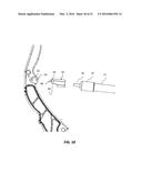 POSITIONING SYSTEM AND DEVICE FOR ARCHERY BOW STABILIZERS diagram and image