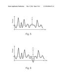 Magnetoelastic torque sensor system for drive train, drive train, method     of measuring torque in a drive train, method of operating a drive train     and method of manufacturing a primary sensor unit diagram and image