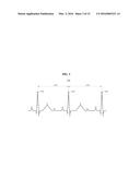 USER AUTHENTICATION METHOD AND APPARATUS BASED ON ELECTROCARDIOGRAM (ECG)     SIGNAL diagram and image