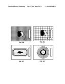 DEVICES AND METHODS FOR DETERMINING MENSTRUAL BLOOD LOSS diagram and image