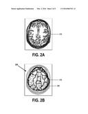 REAL-TIME SUBJECT-DRIVEN FUNCTIONAL CONNECTIVITY ANALYSIS diagram and image