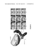 SYSTEMS AND METHODS FOR SEGMENTING MEDICAL IMAGES BASED ON ANATOMICAL     LANDMARK-BASED FEATURES diagram and image