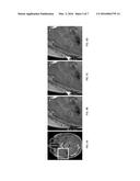 EXPLOITING SIMILARITY IN ADJACENT SLICES FOR COMPRESSED SENSING MRI diagram and image
