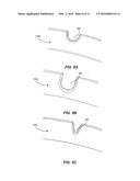 TRENCHED SEALING RETAINER FOR CANAL HEARING DEVICE diagram and image