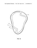 TRENCHED SEALING RETAINER FOR CANAL HEARING DEVICE diagram and image