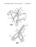 Dog Harness diagram and image