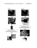 CRYOPRESERVATION OF UMBILICAL CORD TISSUE STRIPS FOR CORD TISSUE-DERIVED     STEM CELLS diagram and image