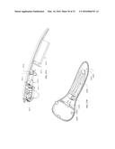 Scanned Laser Vein Contrast Enhancer Using One Laser diagram and image