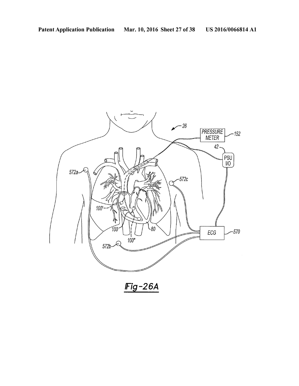 Determining A Location Of A Member - diagram, schematic, and image 28