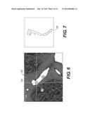 METHOD AND SYSTEM FOR QUANTIFYING LIMITATIONS IN CORONARY ARTERY BLOOD     FLOW DURING PHYSICAL ACTIVITY IN PATIENTS WITH CORONARY ARTERY DISEASE diagram and image