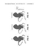 METHOD AND SYSTEM FOR QUANTIFYING LIMITATIONS IN CORONARY ARTERY BLOOD     FLOW DURING PHYSICAL ACTIVITY IN PATIENTS WITH CORONARY ARTERY DISEASE diagram and image