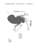 METHOD AND SYSTEM FOR QUANTIFYING LIMITATIONS IN CORONARY ARTERY BLOOD     FLOW DURING PHYSICAL ACTIVITY IN PATIENTS WITH CORONARY ARTERY DISEASE diagram and image