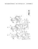 METHOD AND SYSTEM FOR QUANTIFYING LIMITATIONS IN CORONARY ARTERY BLOOD     FLOW DURING PHYSICAL ACTIVITY IN PATIENTS WITH CORONARY ARTERY DISEASE diagram and image