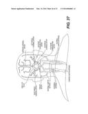 METHOD AND SYSTEM FOR QUANTIFYING LIMITATIONS IN CORONARY ARTERY BLOOD     FLOW DURING PHYSICAL ACTIVITY IN PATIENTS WITH CORONARY ARTERY DISEASE diagram and image