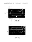 Displaying Computer-Aided Detection Information With Associated Breast     Tomosynthesis Image Information diagram and image