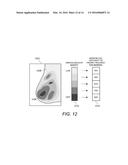 Displaying Computer-Aided Detection Information With Associated Breast     Tomosynthesis Image Information diagram and image