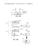 Displaying Computer-Aided Detection Information With Associated Breast     Tomosynthesis Image Information diagram and image