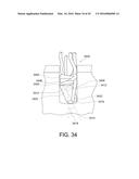 SUTURE ANCHOR diagram and image