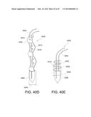 SUTURE ANCHOR diagram and image