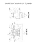 SUTURE ANCHOR diagram and image