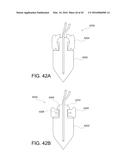 SUTURE ANCHOR diagram and image