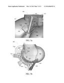 ADAPTIVE SURFACE SURGICAL GUIDING APPARATUS AND SYSTEMS AND METHODS OF     MANUFACTURING ADAPTIVE SURFACE SURGICAL GUIDING APPARATUS diagram and image