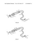 CAPTURE ASSEMBLY AND METHOD diagram and image