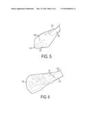 DEVICES AND METHODS FOR REMOVAL OF CALCULUS diagram and image