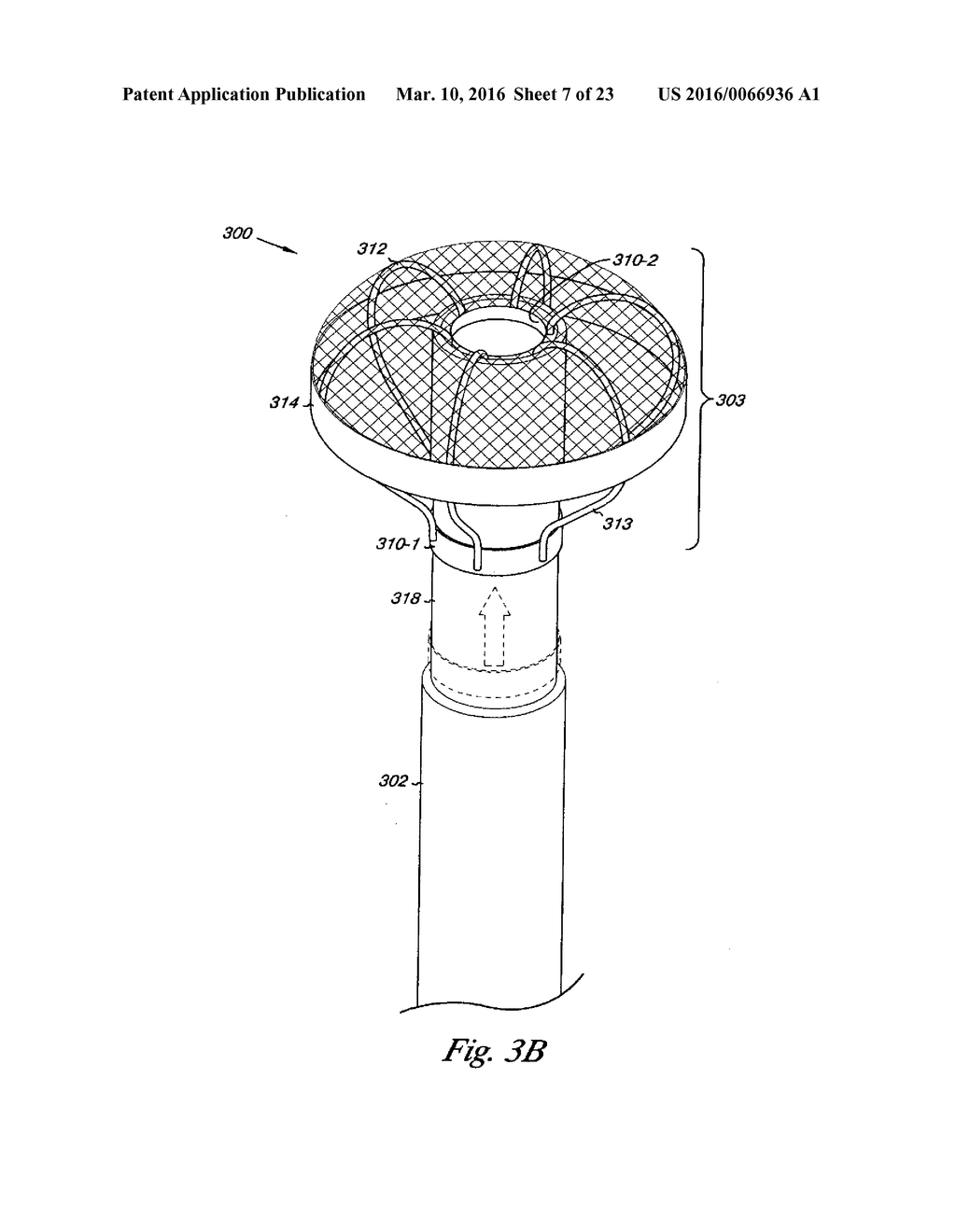 VESSEL OCCLUDING MATERIAL EXTRACTOR - diagram, schematic, and image 08