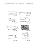 DISCECTOMY KITS WITH AN OBTURATOR, GUARD CANNULA diagram and image