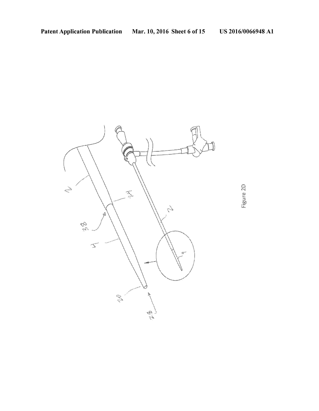 VASCULAR ACCESS CONFIGURATION - diagram, schematic, and image 07