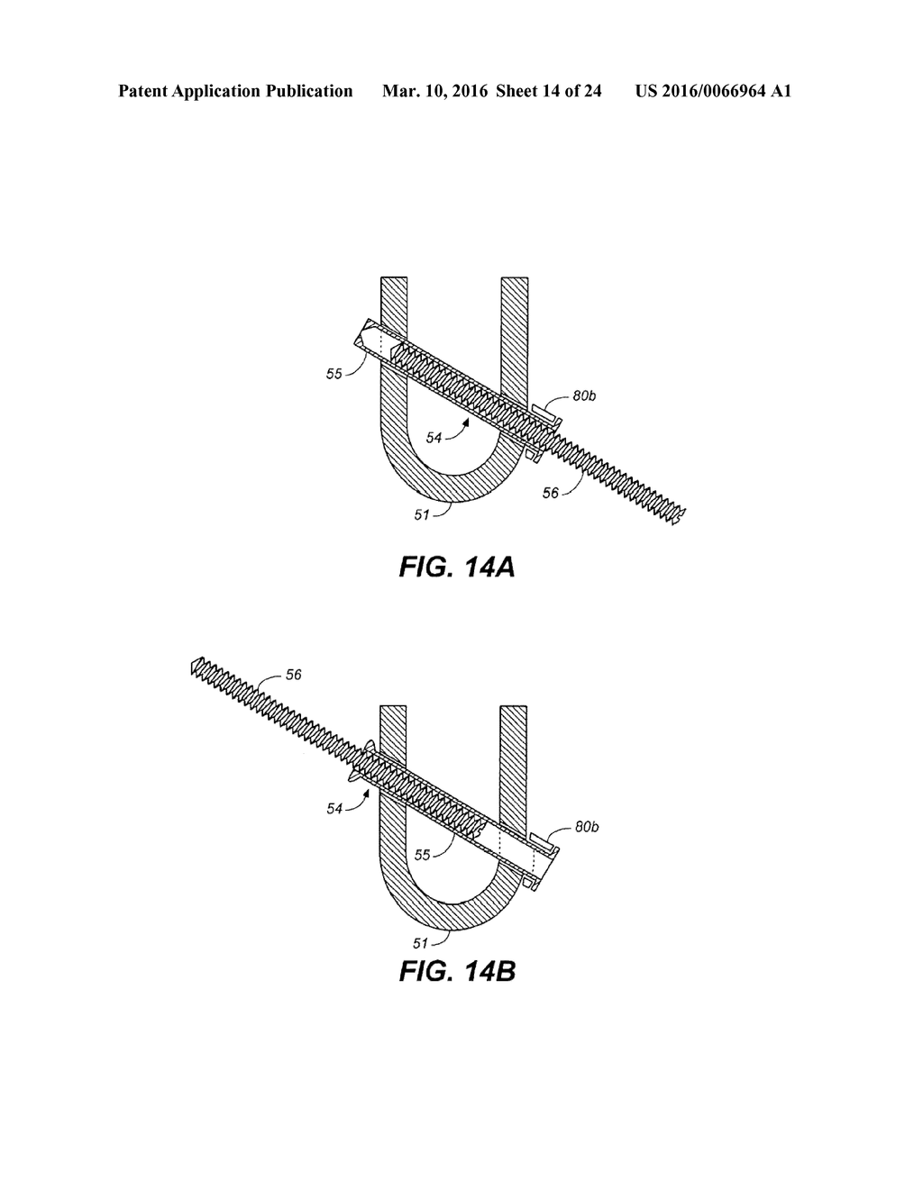 DEVICE AND METHOD FOR CORRECTING A SPINAL DEFORMITY - diagram, schematic, and image 15