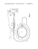 CRYOADHESIVE DEVICE FOR LEFT ATRIAL APPENDAGE OCCLUSION diagram and image