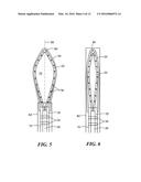 CRYOADHESIVE DEVICE FOR LEFT ATRIAL APPENDAGE OCCLUSION diagram and image