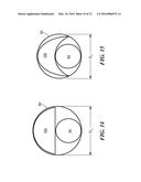 CRYOADHESIVE DEVICE FOR LEFT ATRIAL APPENDAGE OCCLUSION diagram and image