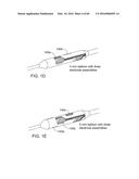 METHODS AND APPARATUSES FOR REMODELING TISSUE OF OR ADJACENT TO A BODY     PASSAGE diagram and image