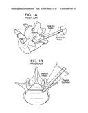 Proximal-End Securement of a Minimally Invasive Working Channel diagram and image