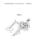 Proximal-End Securement of a Minimally Invasive Working Channel diagram and image