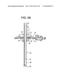 Proximal-End Securement of a Minimally Invasive Working Channel diagram and image