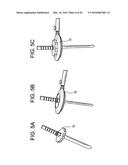 Proximal-End Securement of a Minimally Invasive Working Channel diagram and image