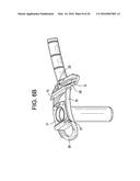 Proximal-End Securement of a Minimally Invasive Working Channel diagram and image