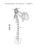 Proximal-End Securement of a Minimally Invasive Working Channel diagram and image