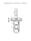 Proximal-End Securement of a Minimally Invasive Working Channel diagram and image