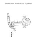 Proximal-End Securement of a Minimally Invasive Working Channel diagram and image