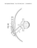 Proximal-End Securement of a Minimally Invasive Working Channel diagram and image