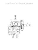 Proximal-End Securement of a Minimally Invasive Working Channel diagram and image