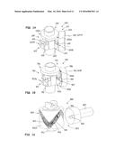 DRIVE DEVICE FOR A MEDICAL, DENTAL OR SURGICAL TOOL diagram and image